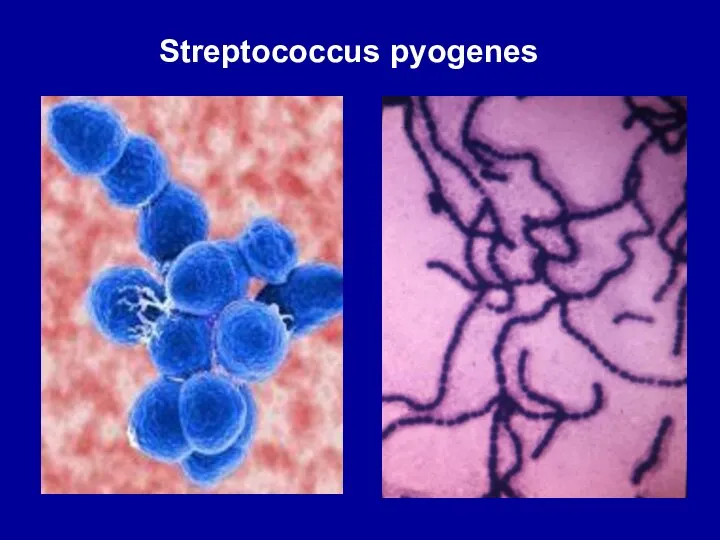 Streptococcus pyogenes