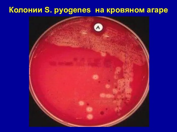 Колонии S. pyogenes на кровяном агаре