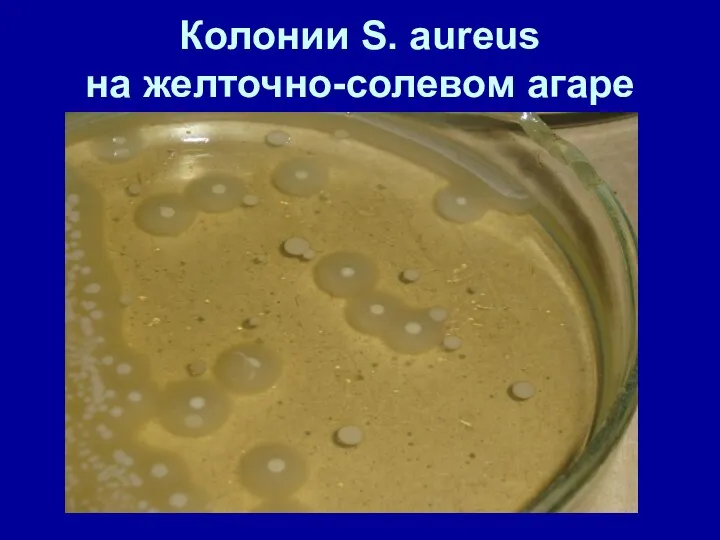 Колонии S. aureus на желточно-солевом агаре