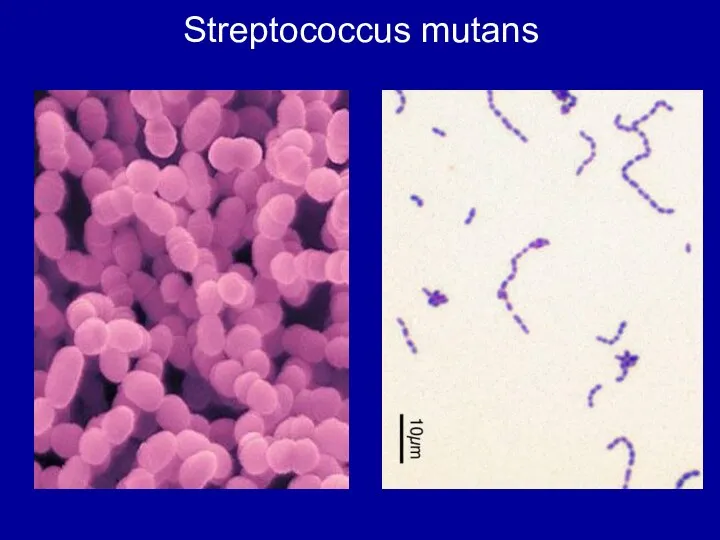 Streptococcus mutans