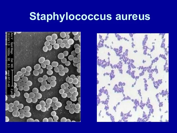 Staphylococcus aureus