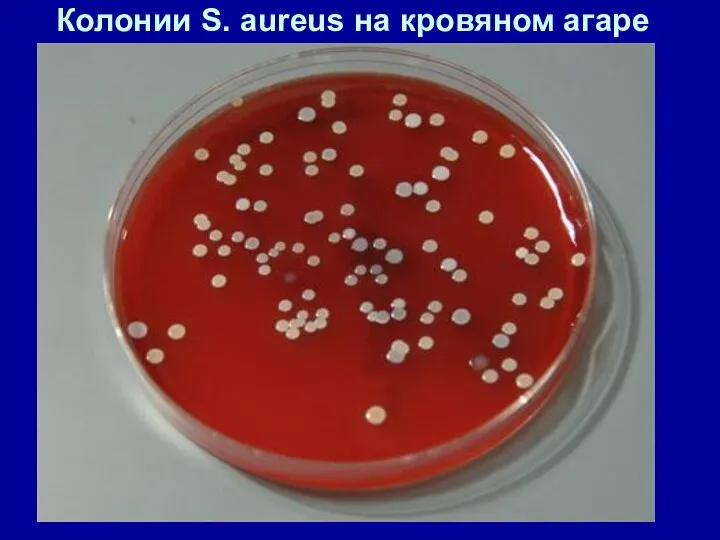 Колонии S. aureus на кровяном агаре