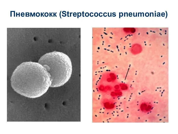 Пневмококк (Streptococcus pneumoniae)