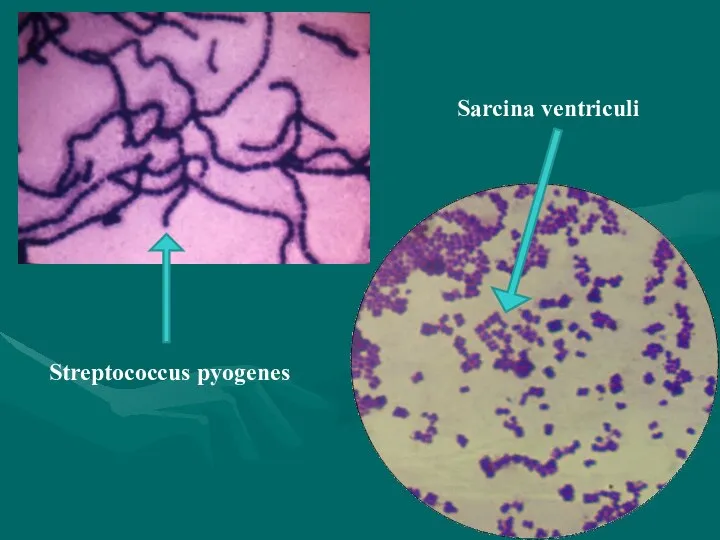 Streptococcus pyogenes Sarcina ventriculi