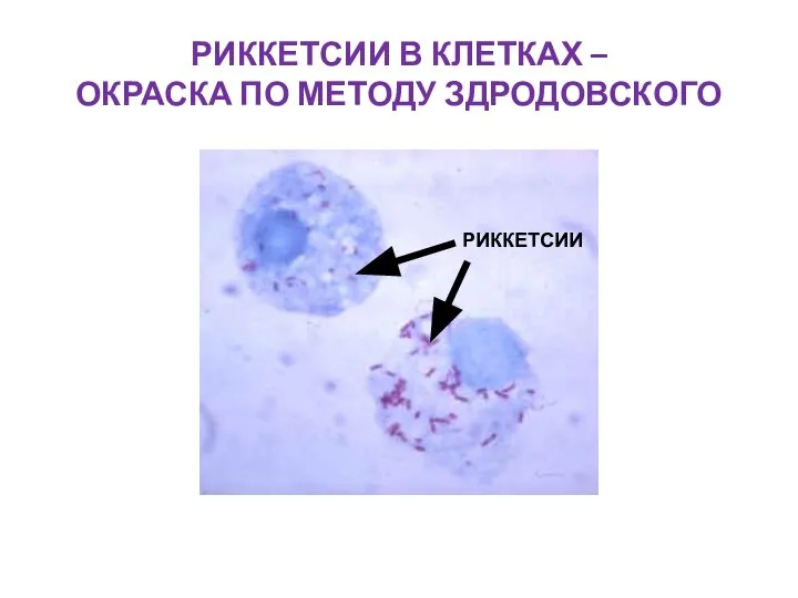 РИККЕТСИИ В КЛЕТКАХ – ОКРАСКА ПО МЕТОДУ ЗДРОДОВСКОГО РИККЕТСИИ