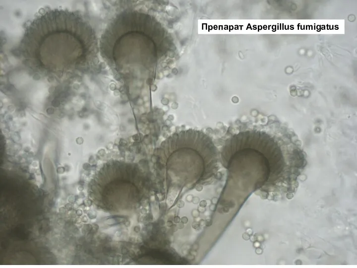 Препарат Aspergillus fumigatus