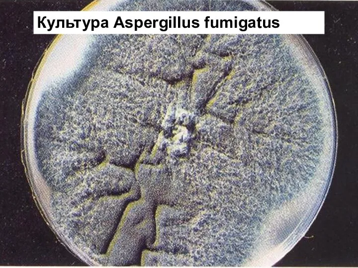 Культура Aspergillus fumigatus