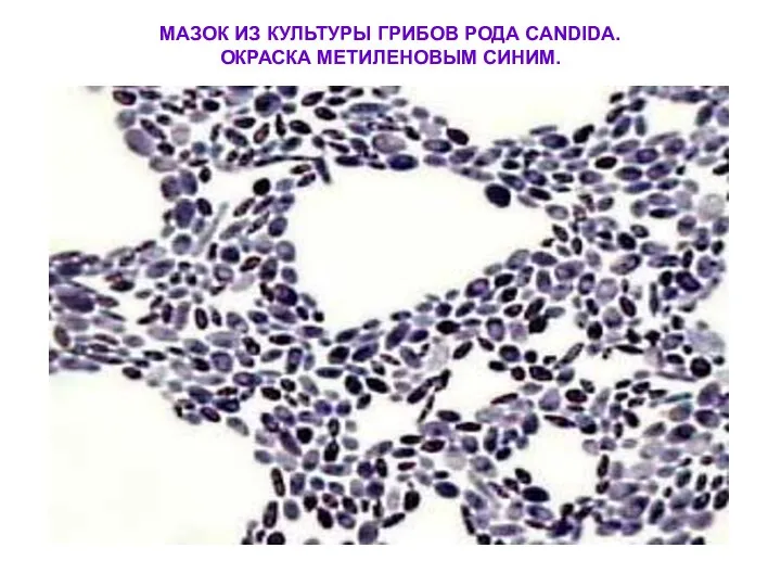 МАЗОК ИЗ КУЛЬТУРЫ ГРИБОВ РОДА CANDIDA. ОКРАСКА МЕТИЛЕНОВЫМ СИНИМ.