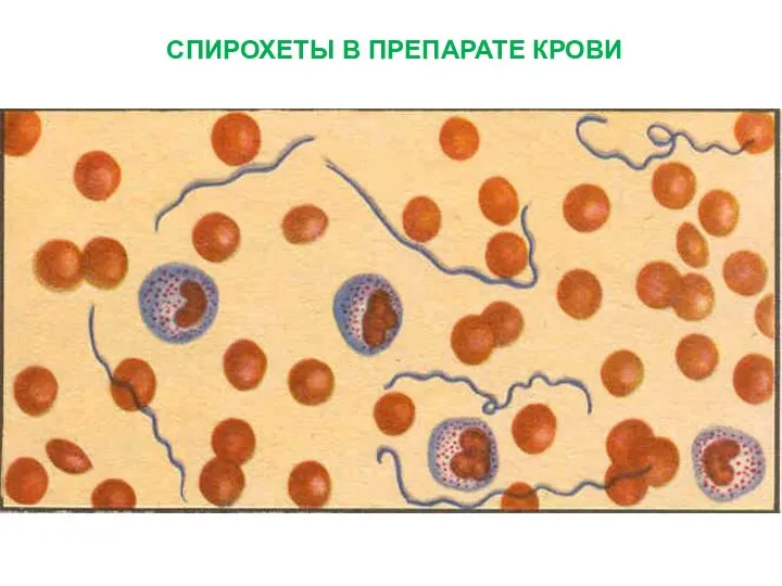 СПИРОХЕТЫ В ПРЕПАРАТЕ КРОВИ