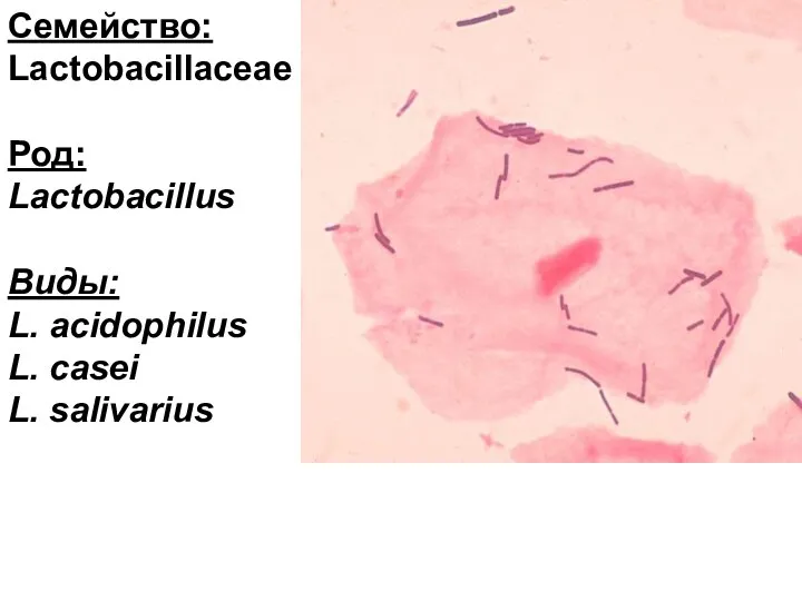 Семейство: Lactobacillaceae Род: Lactobacillus Виды: L. acidophilus L. сasei L. salivarius