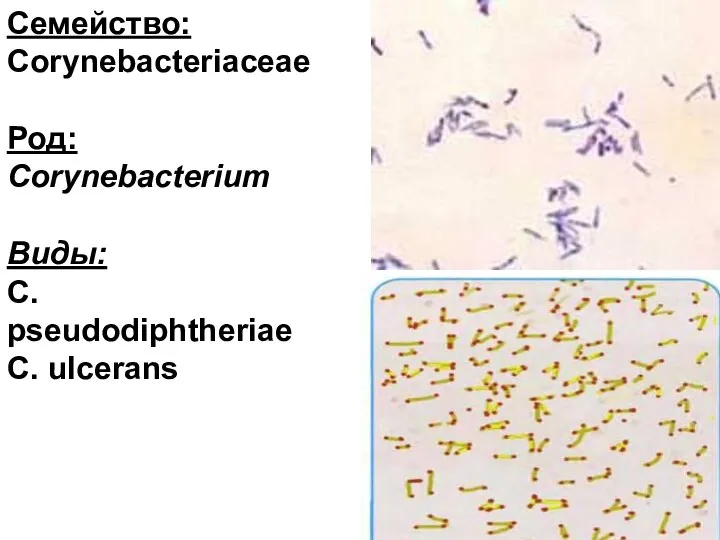 Семейство: Corynebacteriaceae Род: Corynebacterium Виды: С. рseudodiphtheriae С. ulcerans