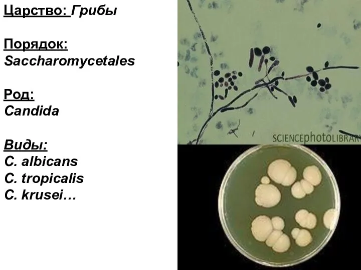 Царство: Грибы Порядок: Saccharomycetales Род: Candida Виды: C. albicans C. tropicalis C. krusei…