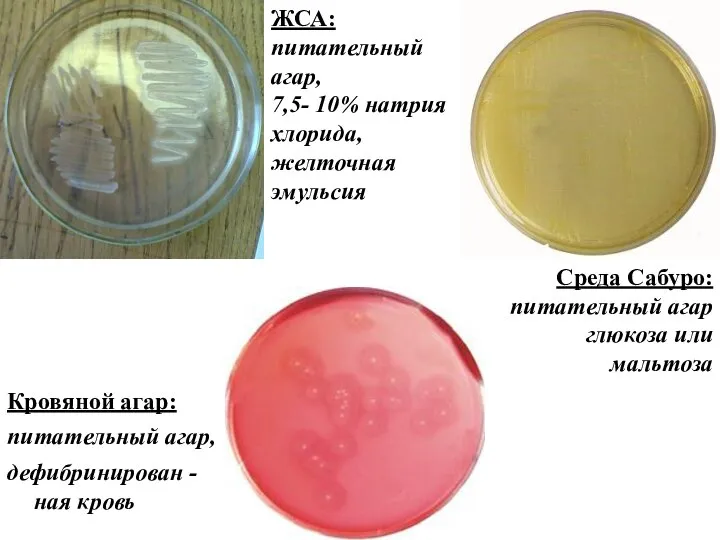 Кровяной агар: питательный агар, дефибринирован -ная кровь Среда Cабуро: питательный агар