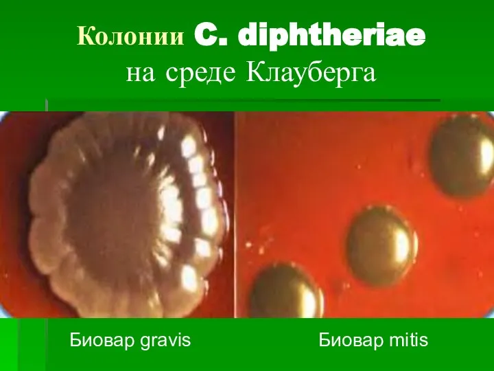 Колонии C. diphtheriae на среде Клауберга Биовар gravis Биовар mitis