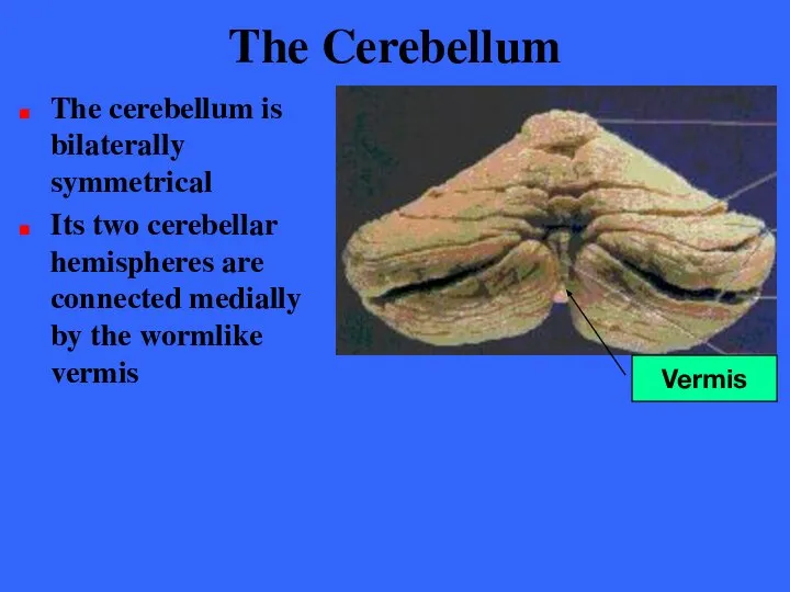 The Cerebellum The cerebellum is bilaterally symmetrical Its two cerebellar hemispheres