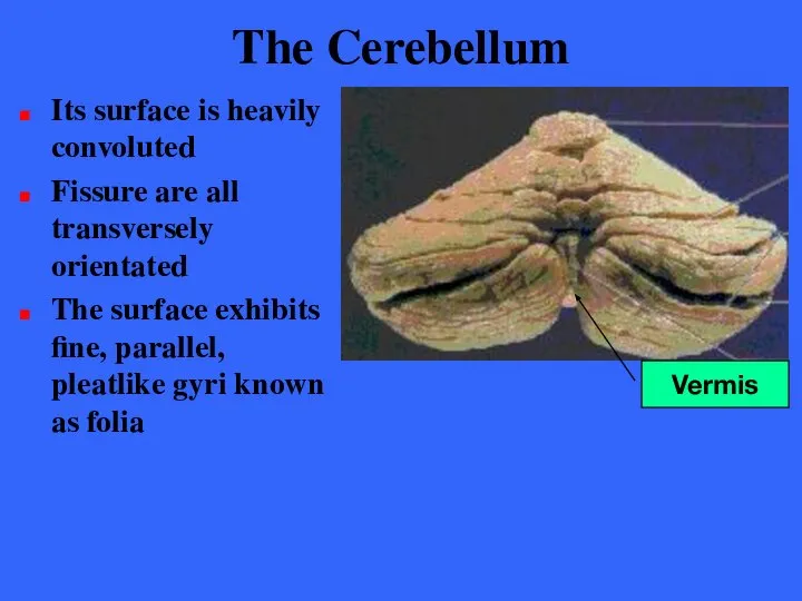 The Cerebellum Its surface is heavily convoluted Fissure are all transversely