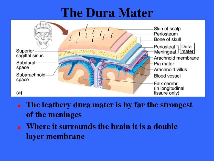 The Dura Mater The leathery dura mater is by far the