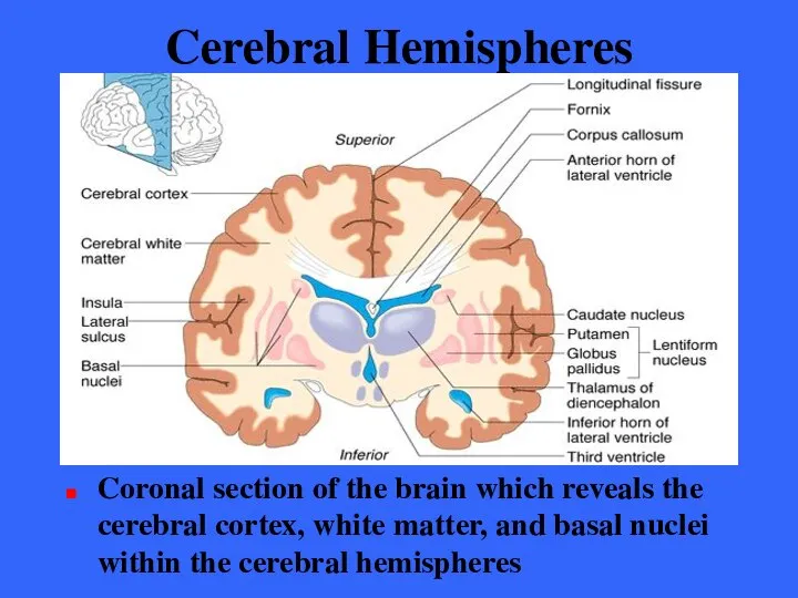 Cerebral Hemispheres Coronal section of the brain which reveals the cerebral