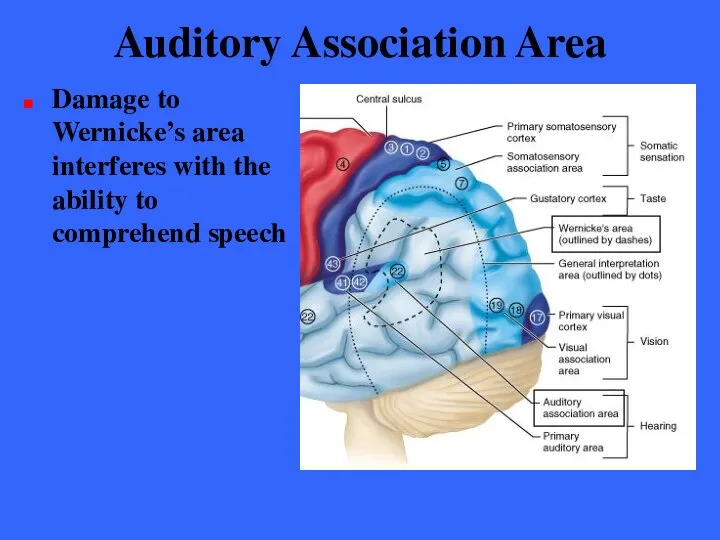 Auditory Association Area Damage to Wernicke’s area interferes with the ability to comprehend speech