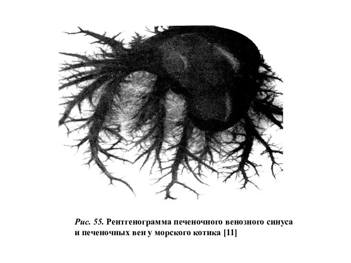 Рис. 55. Рентгенограмма печеночного венозного синуса и печеночных вен у морского котика [11]