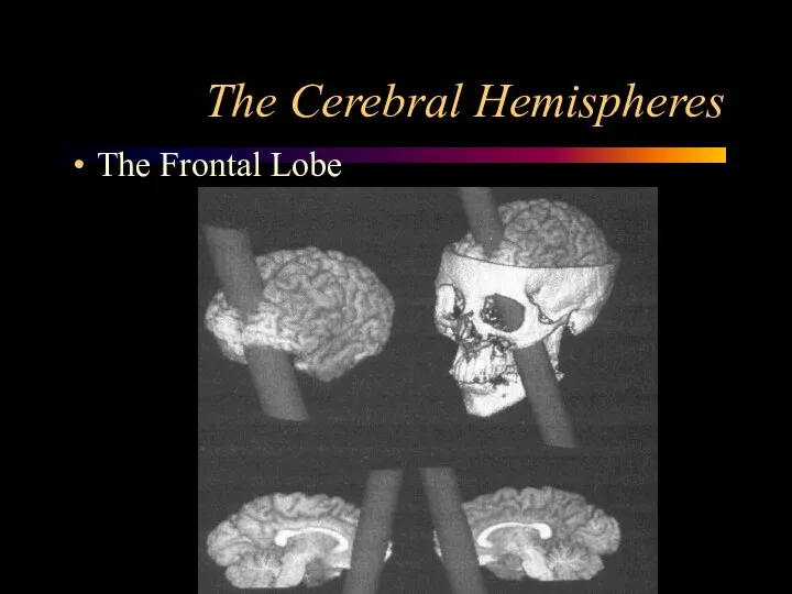 The Cerebral Hemispheres The Frontal Lobe