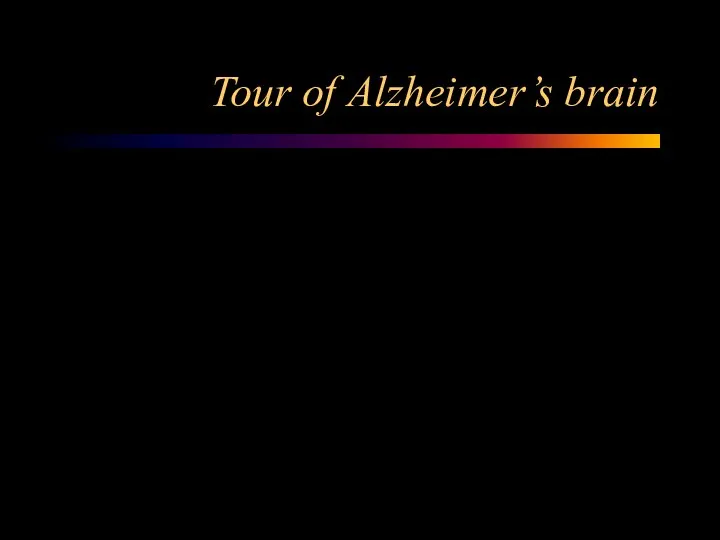 Tour of Alzheimer’s brain