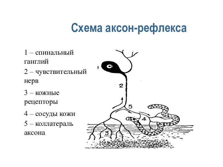 Схема аксон-рефлекса 1 – спинальный ганглий 2 – чувствительный нерв 3