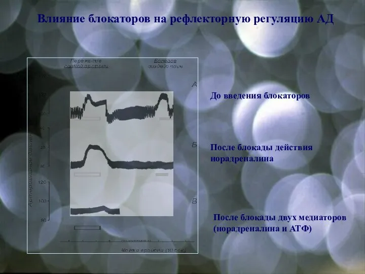 Влияние блокаторов на рефлекторную регуляцию АД До введения блокаторов После блокады