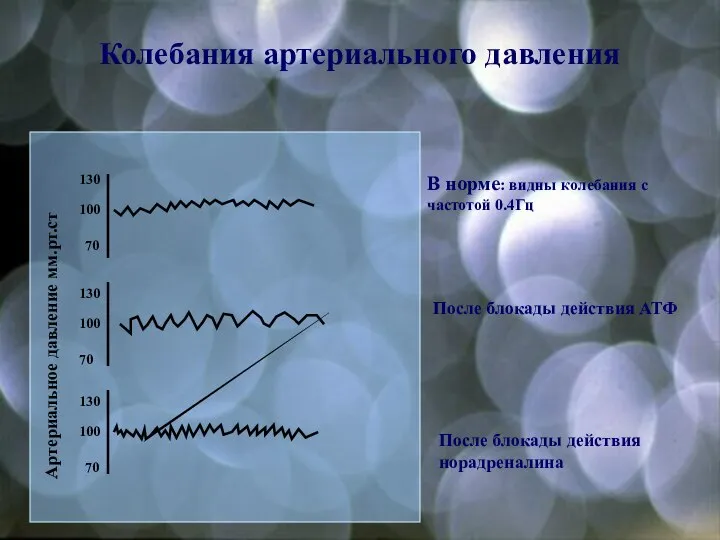 Колебания артериального давления Артериальное давление мм.рт.ст 70 100 130 70 100