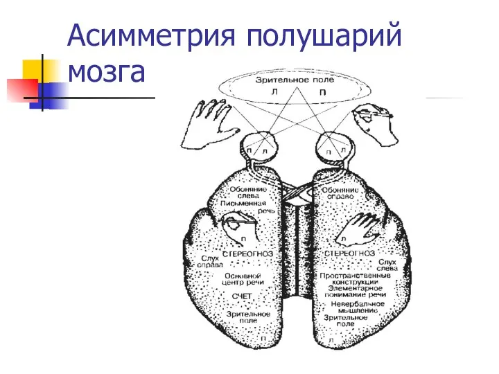 Асимметрия полушарий мозга