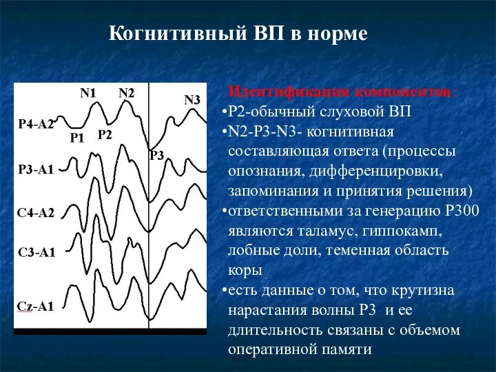 Когнитивный ВП в норме Идентификация компонентов: P2-обычный слуховой ВП N2-P3-N3- когнитивная