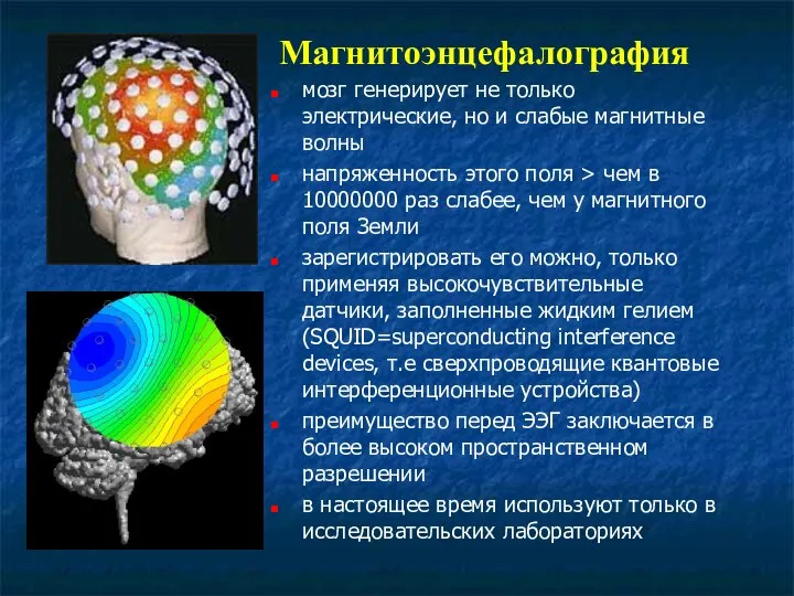 Магнитоэнцефалография мозг генерирует не только электрические, но и слабые магнитные волны