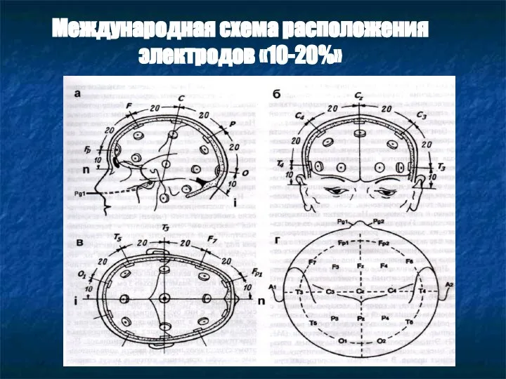 Международная схема расположения электродов «10-20%»