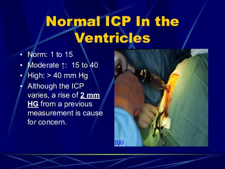 Normal ICP In the Ventricles Norm: 1 to 15 Moderate ↑: