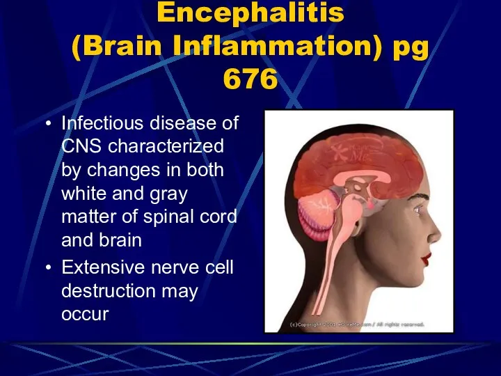 Encephalitis (Brain Inflammation) pg 676 Infectious disease of CNS characterized by