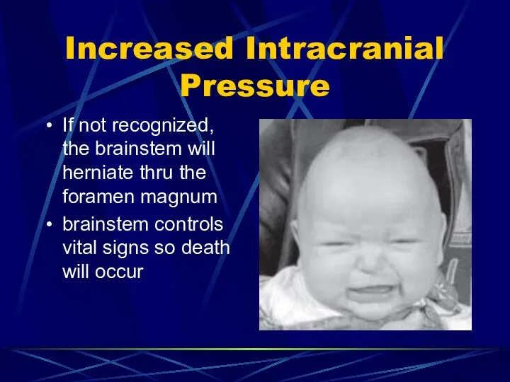 Increased Intracranial Pressure If not recognized, the brainstem will herniate thru