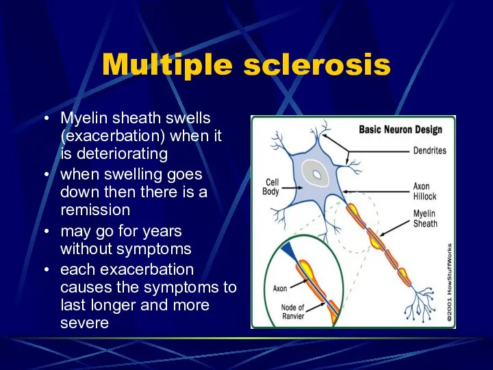 Multiple sclerosis Myelin sheath swells (exacerbation) when it is deteriorating when