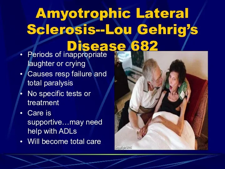 Amyotrophic Lateral Sclerosis--Lou Gehrig’s Disease 682 Periods of inappropriate laughter or