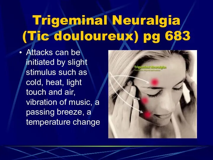Trigeminal Neuralgia (Tic douloureux) pg 683 Attacks can be initiated by