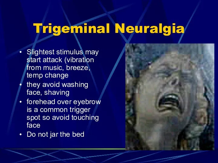 Trigeminal Neuralgia Slightest stimulus may start attack (vibration from music, breeze,