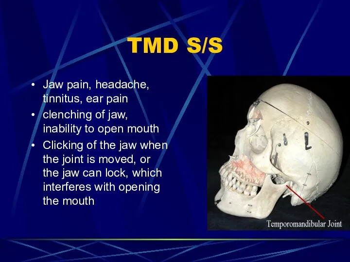 TMD S/S Jaw pain, headache, tinnitus, ear pain clenching of jaw,