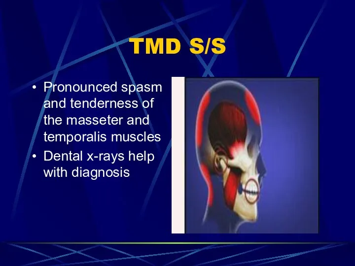 TMD S/S Pronounced spasm and tenderness of the masseter and temporalis