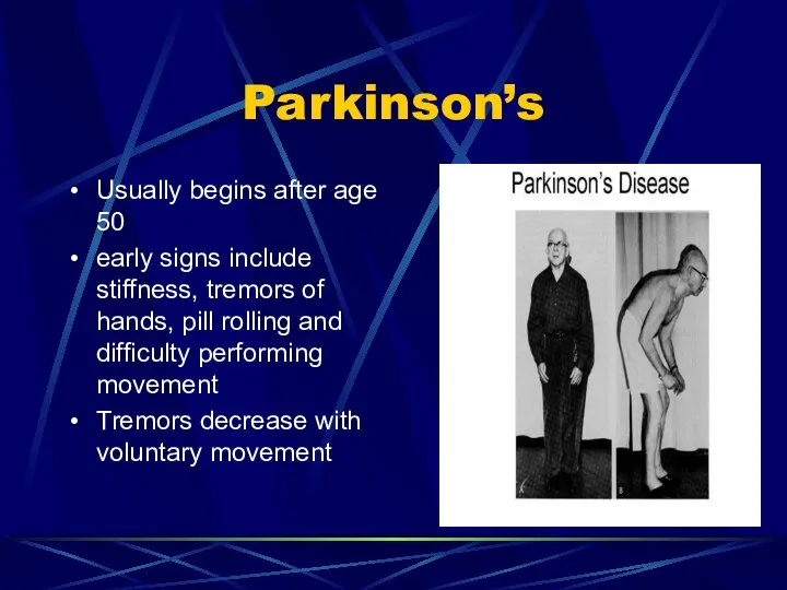 Parkinson’s Usually begins after age 50 early signs include stiffness, tremors