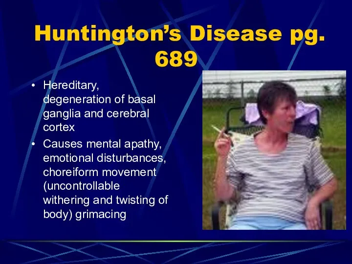 Huntington’s Disease pg. 689 Hereditary, degeneration of basal ganglia and cerebral