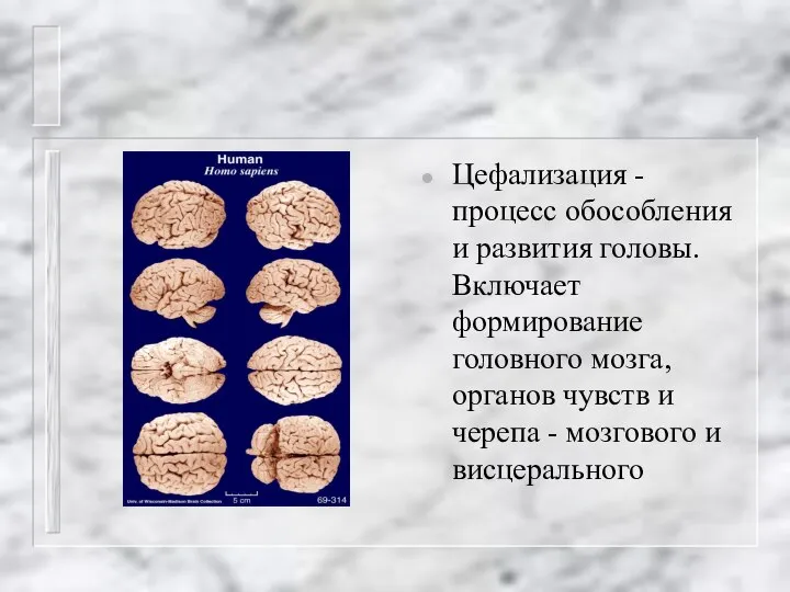 Цефализация - процесс обособления и развития головы. Включает формирование головного мозга,