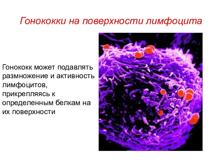 Гонококки на поверхности лимфоцита Гонококк может подавлять размножение и активность лимфоцитов,