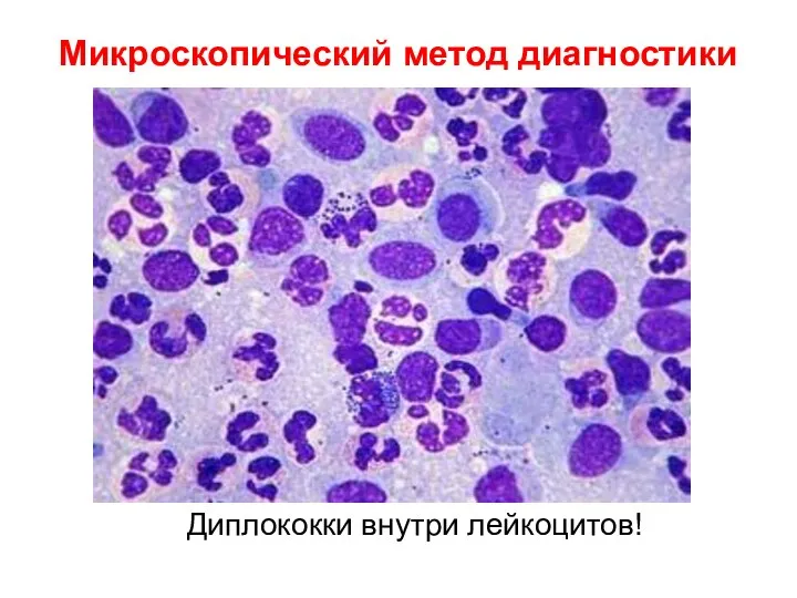 Микроскопический метод диагностики Диплококки внутри лейкоцитов!