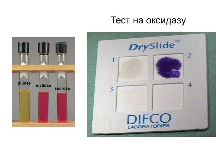 Тест на оксидазу