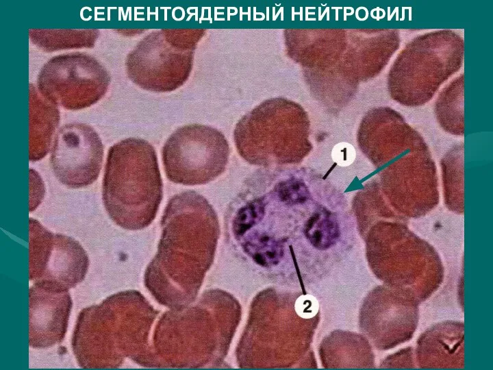 СЕГМЕНТОЯДЕРНЫЙ НЕЙТРОФИЛ