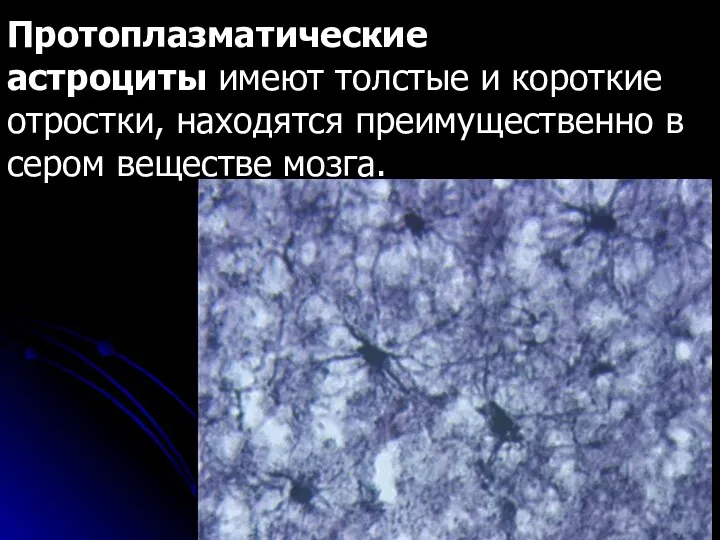 Протоплазматические астроциты имеют толстые и короткие отростки, находятся преимущественно в сером веществе мозга.